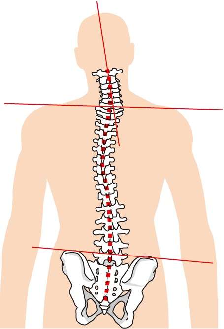 腰痛は骨盤の歪みが原因｜草加で腰痛にお困りならしげの鍼灸院・接骨院